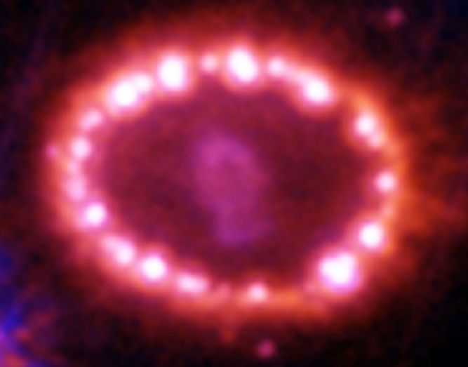 SN1987A's Cosmic Pearls